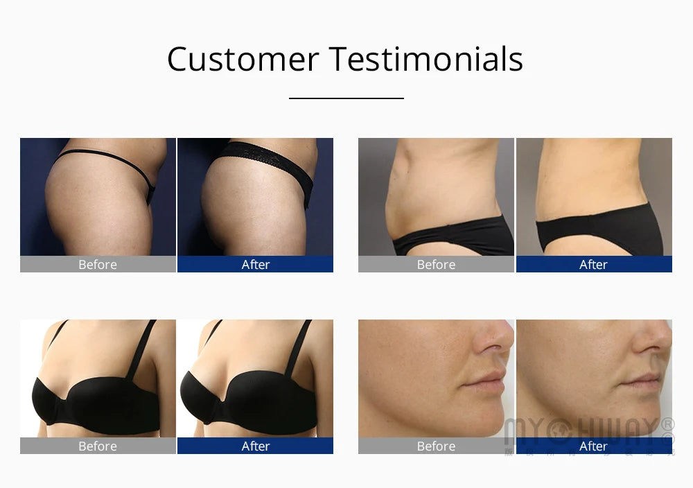 Muscle Stimulation Vacuum Therapy Body Enhancement Machine