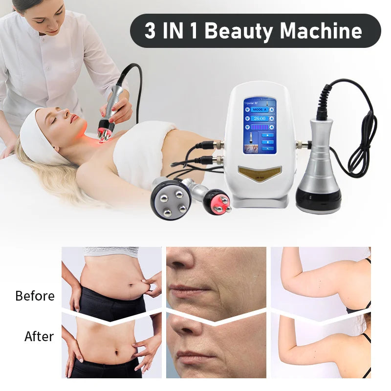 RF Body Massager Machine 3-in-1 40K