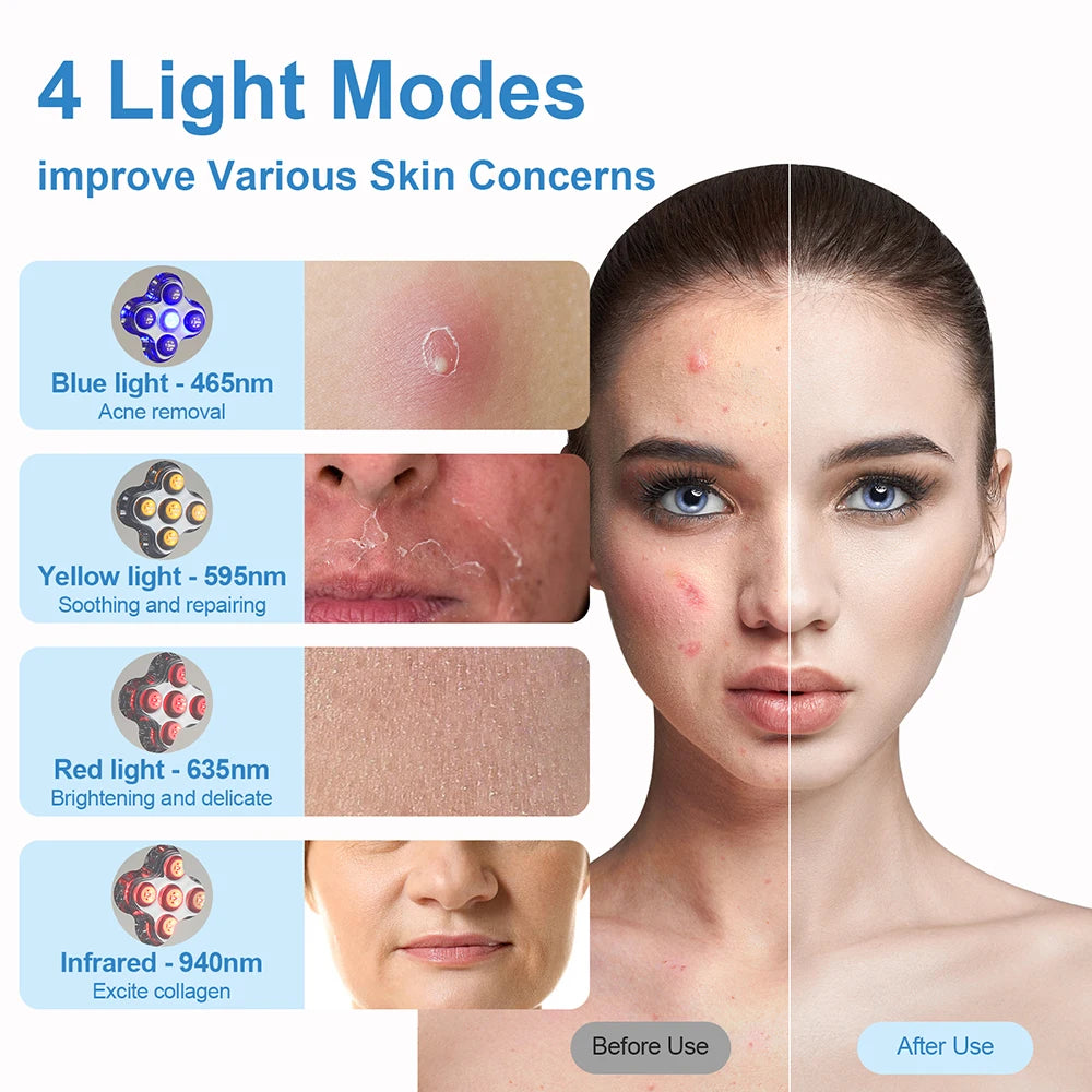 Wireless Face Body 4 Colors LED Photon Beauty Board Red Light Skin Rejuvenation