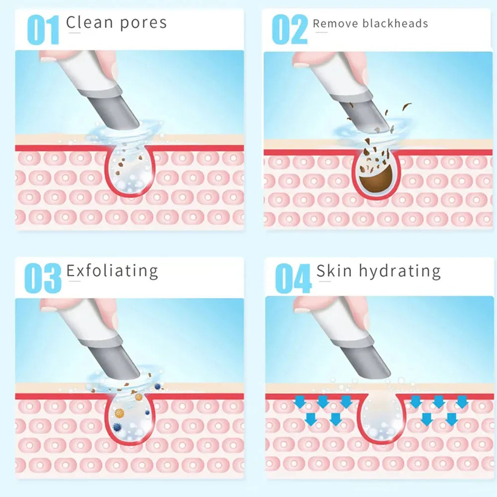 Dermabrasion Facial Cleaning Oxygen Instrument Hydra Aqua Suction Blackhead
