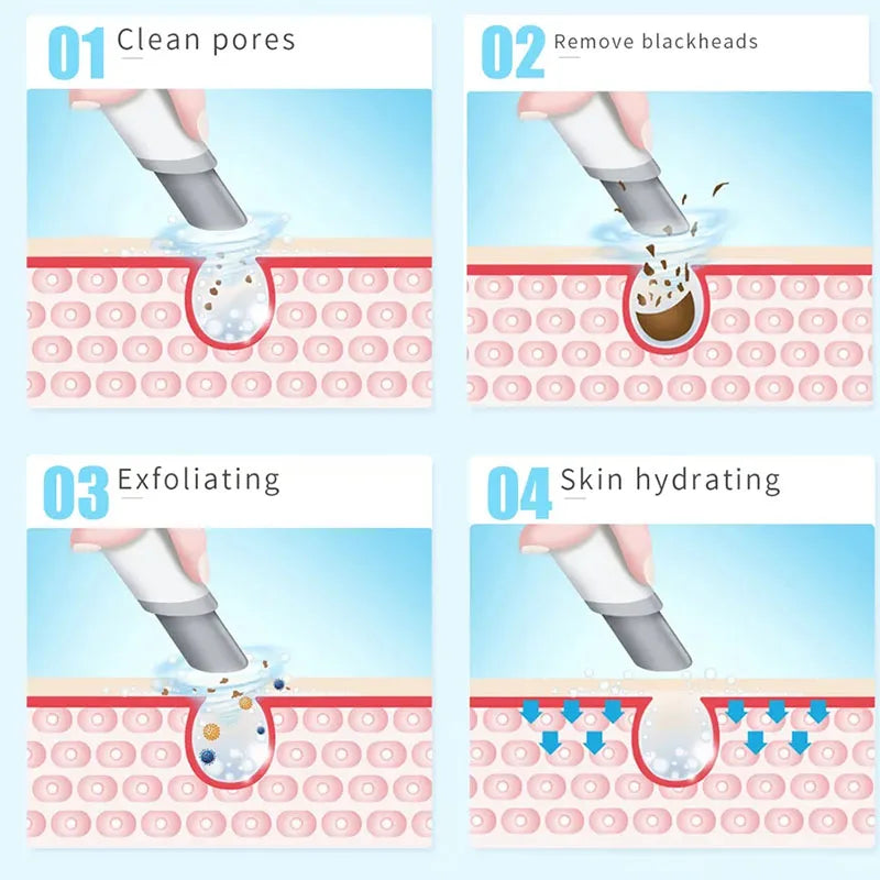 Dermabrasion Facial Cleaning Oxygen Instrument Hydra Aqua Suction Blackhead